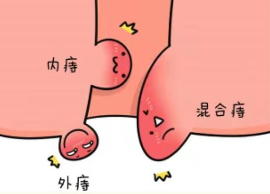 痔瘡凝膠定制廠家